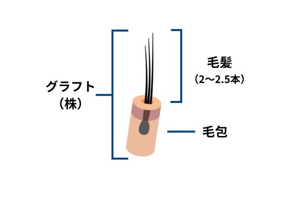 自毛植毛の料金相場