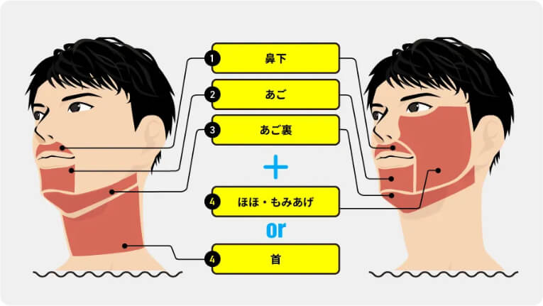 メンズリゼヒゲ脱毛4部位