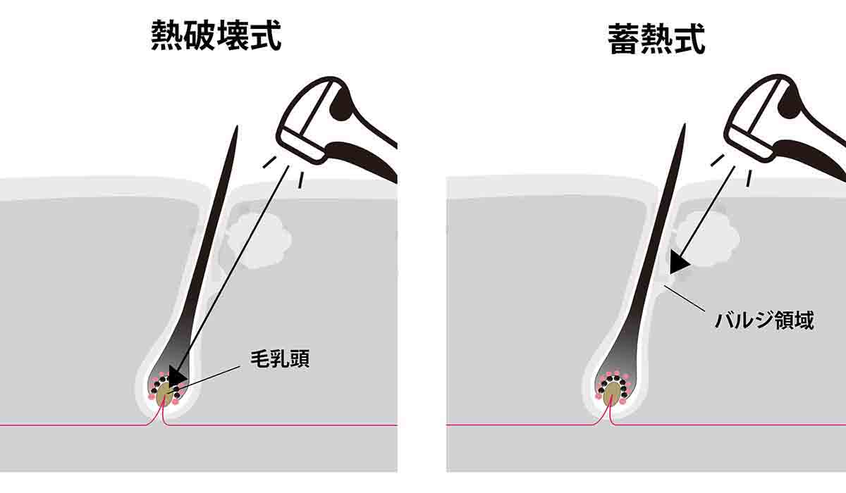 熱破壊式と蓄熱式の図解