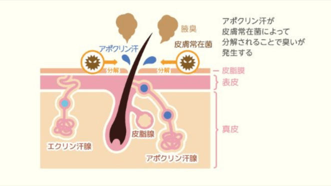 ワキガの仕組み