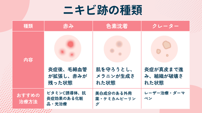 ニキビ跡の種類