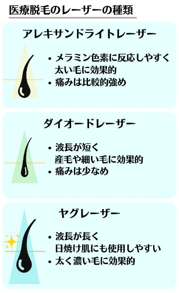 医療脱毛クリニックの脱毛方式・レーザー