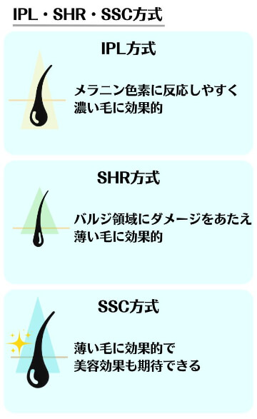 脱毛サロンの脱毛方式