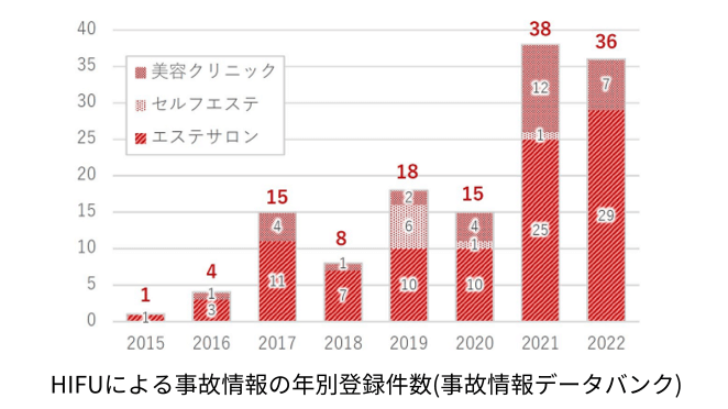 HIFU施術による事故