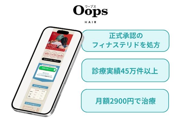 Oops（ウープス）