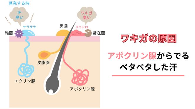 ワキガの原因の図解